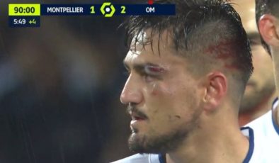 Montpellier maçında kaşı açılan Cengiz Ünder son durumunu paylaştı