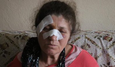 Bolu’da eşinin ağabeyi ve yeğeni tarafından acımasızca dövüldü