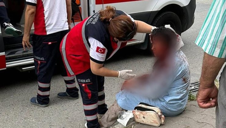Sonu gelmiyor! Ataşehir’de köpek saldırısına uğrayan kadının boynu ve başı parçalandı